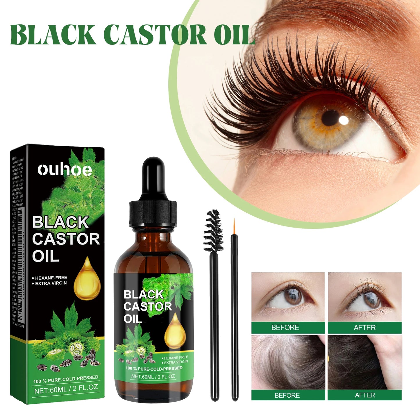 Black Castor Oil Nourishes Hair Growth Care Massage Scalp Treatment Baldness Repair Hydrates Liquid Anti Frizz Loss Hair Serum