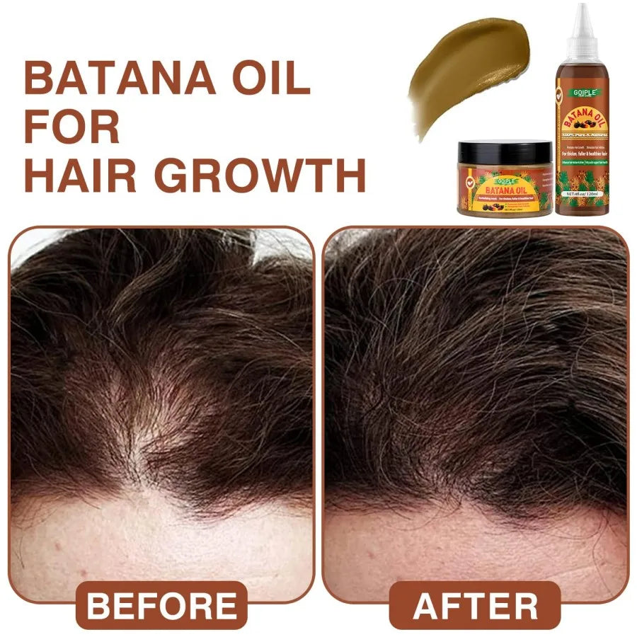 100% Raw Batana Oil for Hair Growth Serum Prevent Hair Loss Repairs Damaged Deeply Nourish Scalp Hair Mask for Thicker Treatment